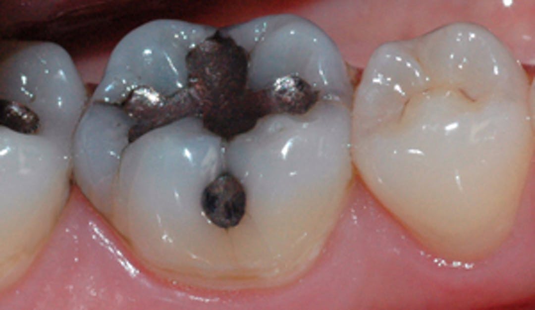 Amalgam_thumb_w300__bca8be799ca62b58898bfc958c583922