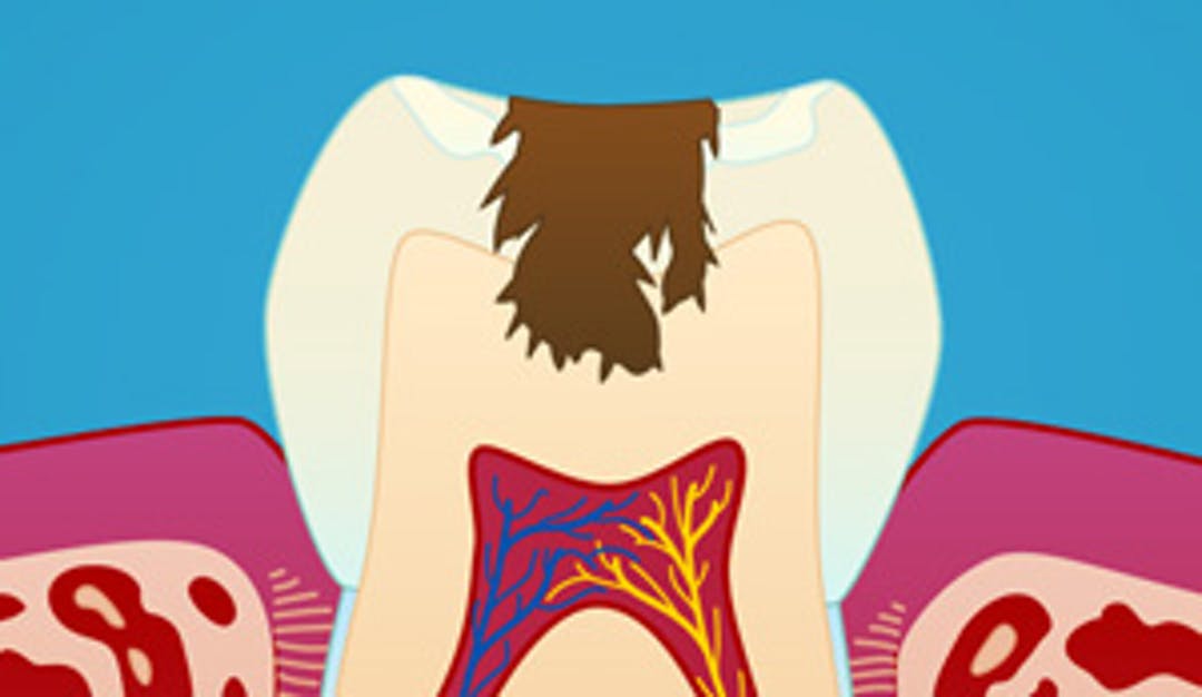 Hull_i_tennene_w300-1__70ebbbe43b769ca0f62159b01adb2dca