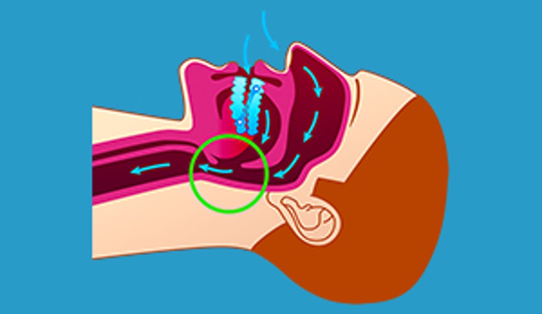 Snorkeskinne_thumbnail_w300__c34a77f748e588fa68f3def3c47e9d5e