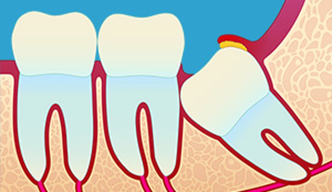 Visdomstenner_w300__56ff7cfdf655ca741cc781ab8c33455c